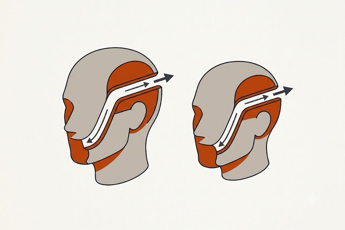 A shortened muzzle compresses the same soft tissue into less space